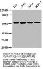 TUBB Monoclonal Antibody