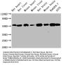TUBB Monoclonal Antibody