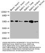 TUBB Monoclonal Antibody