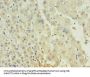 AFP Monoclonal Antibody
