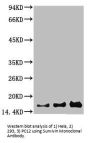 Survivin Monoclonal Antibody
