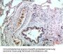 MAPK14 Monoclonal Antibody
