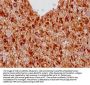 GFAP Monoclonal Antibody