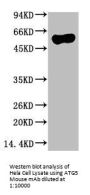 ATG5 Monoclonal Antibody