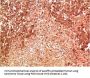MAPK14 Monoclonal Antibody