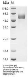 Recombinant Mouse Plasminogen activator inhibitor 2, macrophage(Serpinb2)