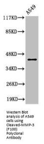 Cleaved-MMP3 (F100) Antibody