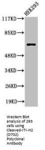 Cleaved-ITIH2 (D702) Antibody