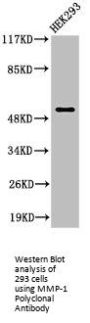 MMP1 Antibody