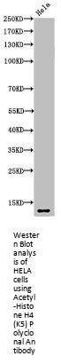 Acetyl-Histone H4 (K5) Antibody