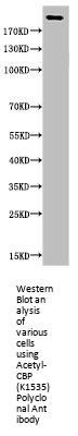 Acetyl-CREBBP (K1535) Antibody