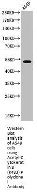 Acetyl-KRT8 (K483) Antibody