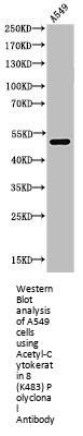 Acetyl-KRT8 (K483) Antibody