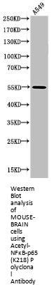 Acetyl-RELA (K218) Antibody