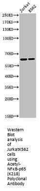 Acetyl-RELA (K218) Antibody