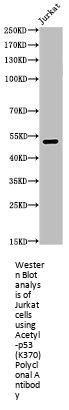 Acetyl-TP53 (K370) Antibody