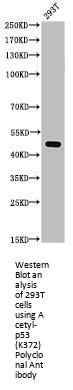 Acetyl-TP53 (K372) Antibody