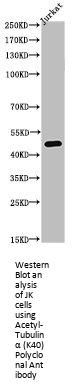 Acetyl-TUBA1A (K40) Antibody