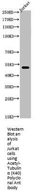 Acetyl-TUBA1A (K40) Antibody