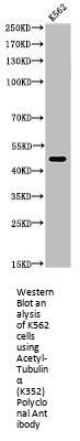 Acetyl-TUBA1A (K352) Antibody