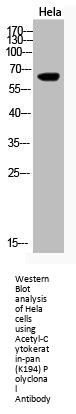 Acetyl-KRT (K194) Antibody