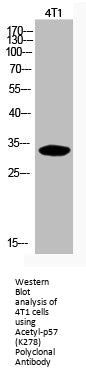 Acetyl-CDKN1C (K278) Antibody