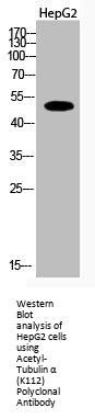 Acetyl-TUBA1A/TUBA1B/TUBA1C (K112) Antibody