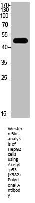 Acetyl-TP53 (K382) Antibody