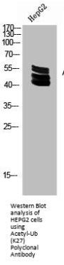 Acetyl-UBA52/RPS27A/UBB/UBC (K27) Antibody