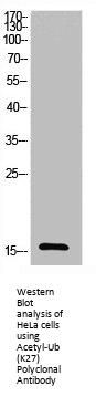 Acetyl-UBA52/RPS27A/UBB/UBC (K27) Antibody