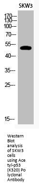 Acetyl-TP53 (K320) Antibody