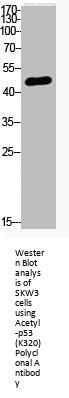 Acetyl-TP53 (K320) Antibody