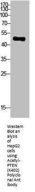 Acetyl-PTEN (K402) Antibody