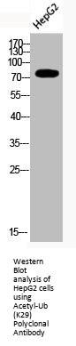 Acetyl-UBA52/RPS27A/UBB/UBC (K29) Antibody