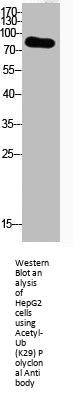 Acetyl-UBA52/RPS27A/UBB/UBC (K29) Antibody