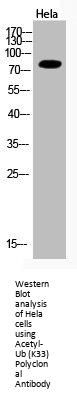 Acetyl-UBA52/RPS27A/UBB/UBC (K33) Antibody