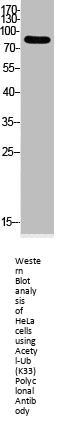 Acetyl-UBA52/RPS27A/UBB/UBC (K33) Antibody