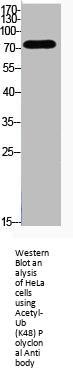 Acetyl-UBA52/RPS27A/UBB/UBC (K48) Antibody