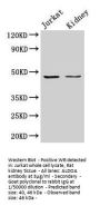 ALDOA Antibody