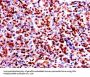 GAPDH Antibody