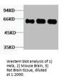 FOS Antibody