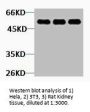 TUBB2A Antibody
