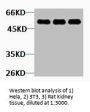 TUBB2A Antibody