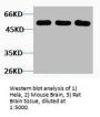 TUBB3 Antibody
