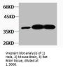GAP43 Antibody