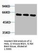 TUBB3 Antibody