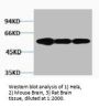 VIM Antibody