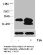 Acetyl-Histone H4 (Lys5) Antibody