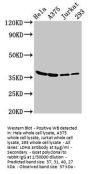 LDHA Antibody