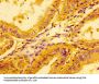 LDHA Antibody